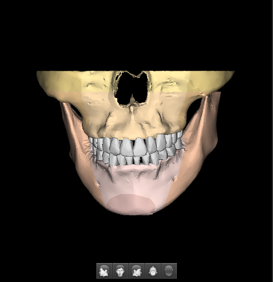 Ez3D-i