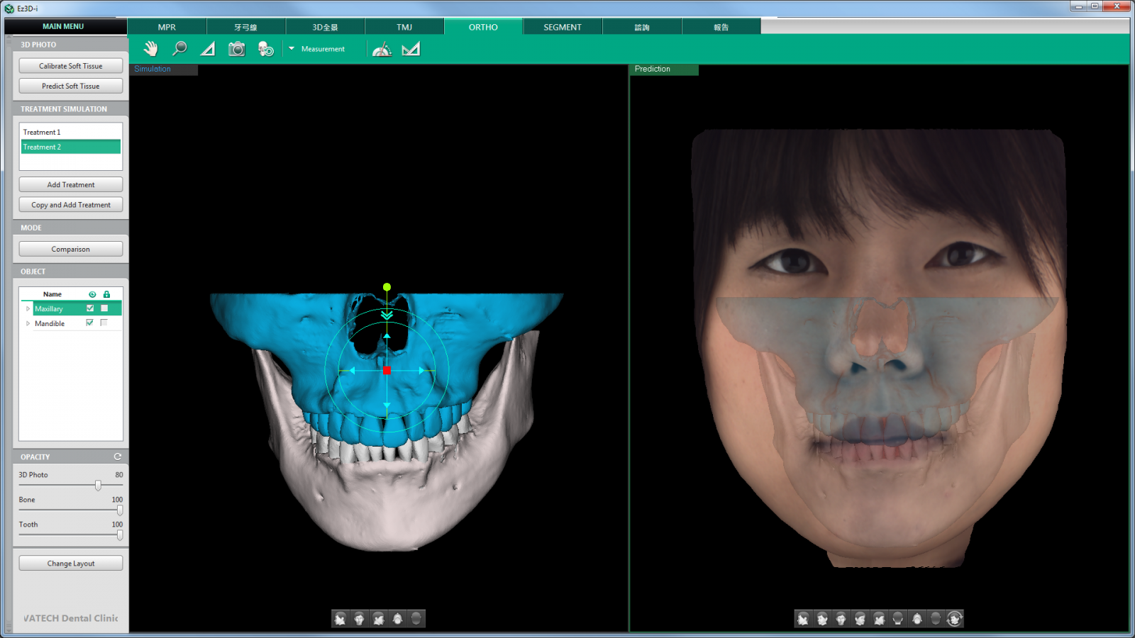 Ez3D-i