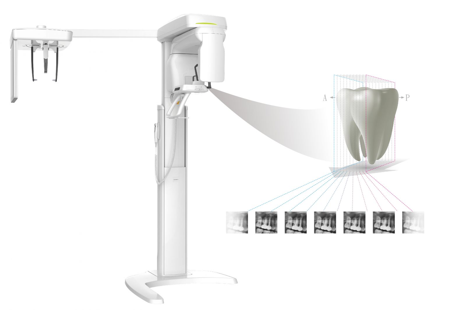 PaX-i Insight 牙科 2D 影像設備