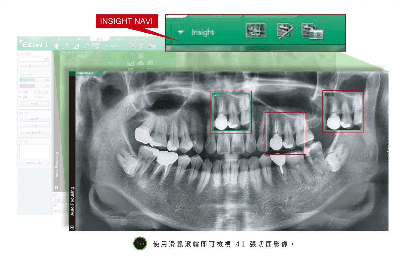 PaX-i Insight 牙科 2D 影像設備